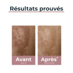 Eucerin Anti-Pigment Soin de Jour SPF30 50ml - Anti-Taches & Éclat – Image 2