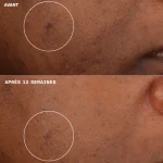 Clinique Even Better Clinical Crème Hydratante Illuminatrice 50ml – Image 5