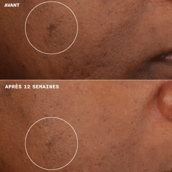 Clinique Even Better Clinical Crème Hydratante Illuminatrice 50ml – Image 5