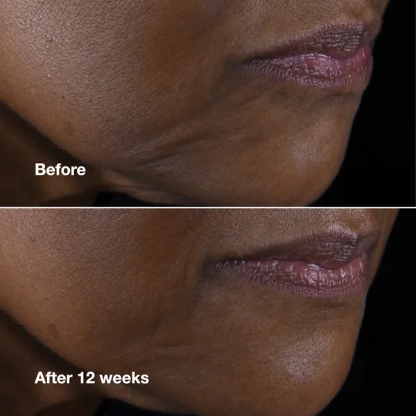 Crème Liftante Visage et Cou