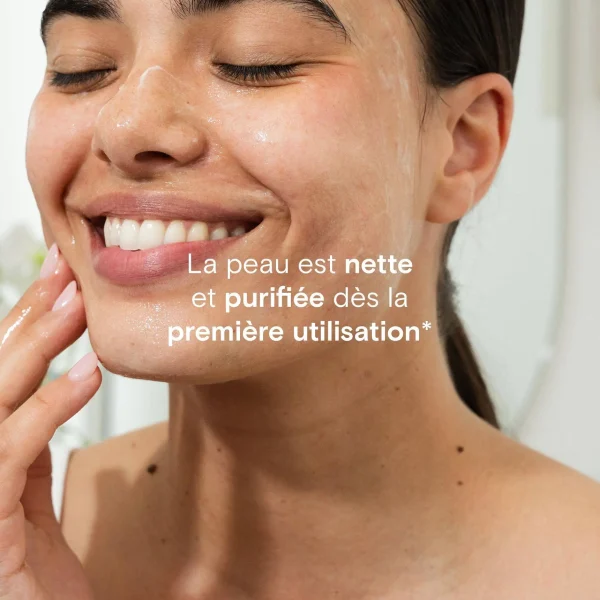 Gel nettoyant anti-imperfections