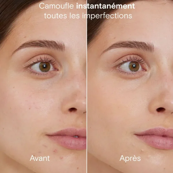 Stick Correcteur Teinté Anti-Imperfections