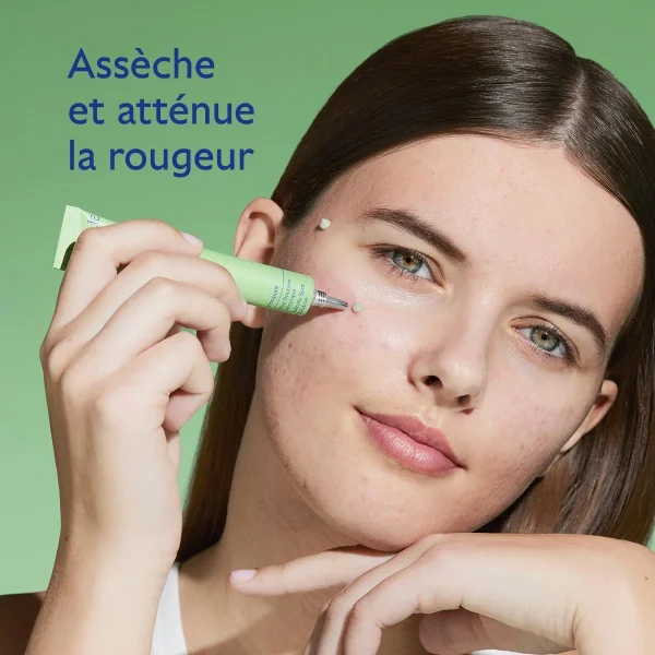 Stop Boutons à l'Acide Salicylique