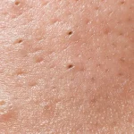 Effaclar Duo+M Unifiant