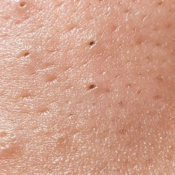 Effaclar Duo+M Unifiant