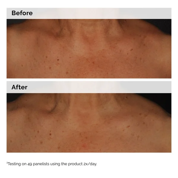 Émulsion Visage et Corps à la Niacinamide 5%