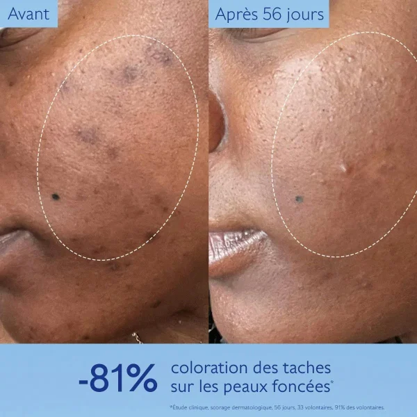 Sérum Éclat Anti-Taches Vinoperfect