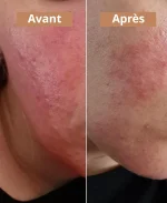 Crème solide à l'huile de noisette