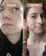 Crème solide à l'huile de noisette