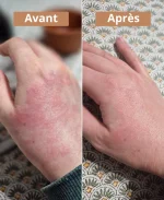 Crème solide au macérât de plantain