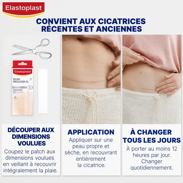 Elastoplast Réducteur de cicatrices