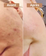 Savon à l'huile de baies de laurier